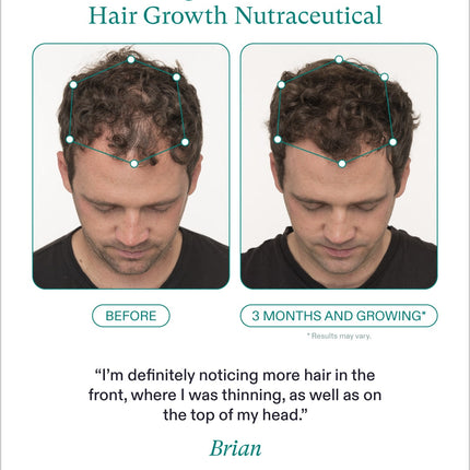 Nutrafol Men's Hair Growth Nutraceutical