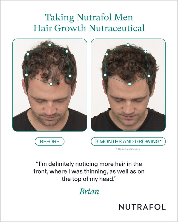 Nutrafol Men's Hair Growth Nutraceutical