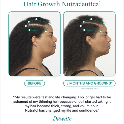 Nutrafol Women's Formula for Hair Growth