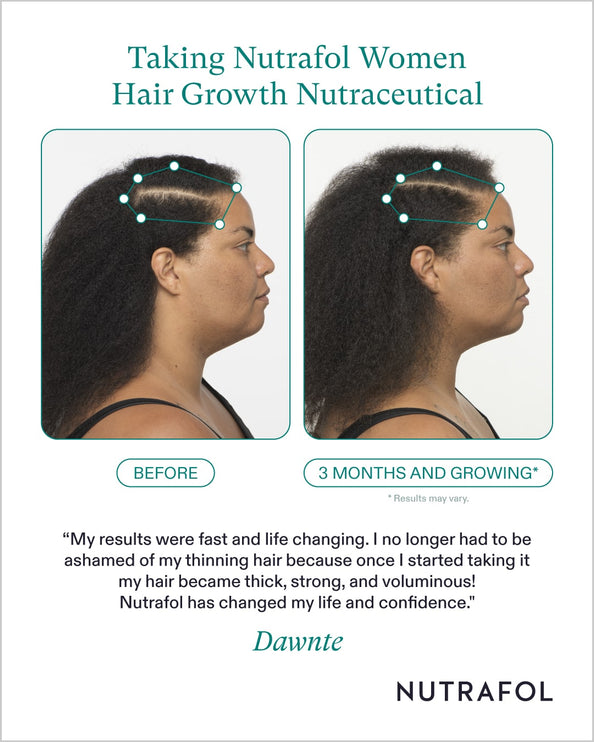 Nutrafol Women's Formula for Hair Growth