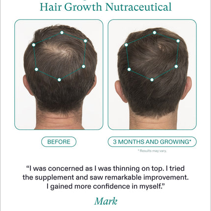 Nutrafol Men's Hair Growth Nutraceutical