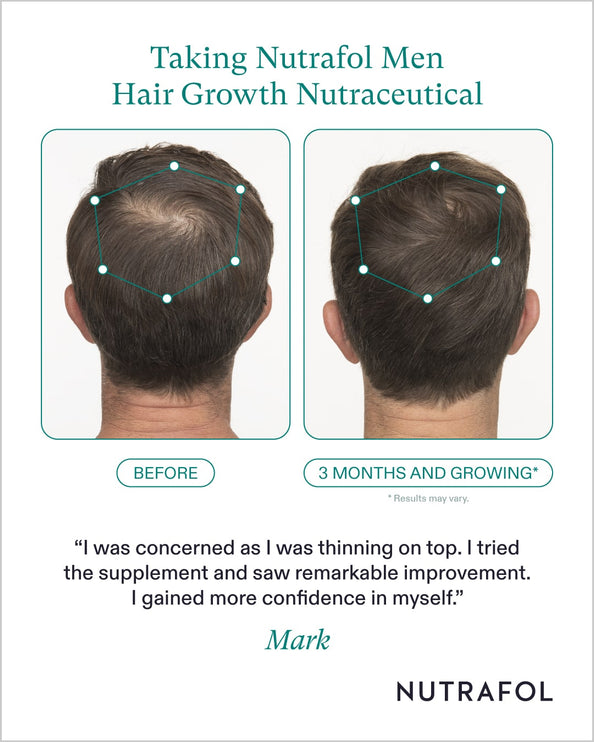 Nutrafol Men's Hair Growth Nutraceutical