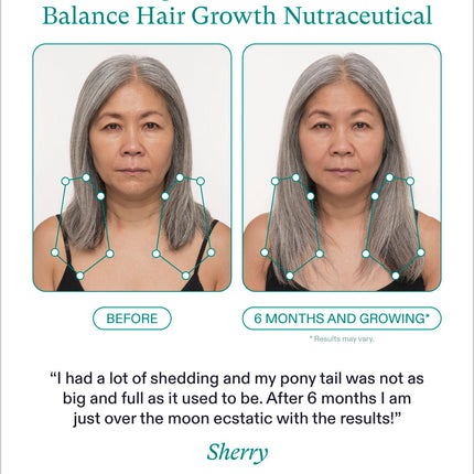 Nutrafol Women's Balance for Hair Growth